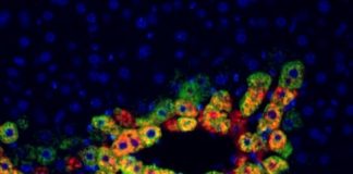 Study: Serendipitous observation opens the door for a precision medicine treatment — (Details)