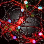 Study: Hyperactive brain cells may be to blame when antidepressants don’t work — (Details)