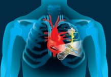 Research: Harnessing the heartbeat to charge batteries —