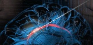 Research: Effects of electrical stimulation of cingulum bundle —