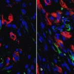 Study: Stem-cell scientists show that petri dish-built matrices of vessels integrate well with existing heart tissue — (Details)