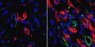 Study: Stem-cell scientists show that petri dish-built matrices of vessels integrate well with existing heart tissue — (Details)