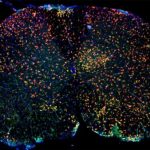 Study: Newly discovered immune cells play role in inflammatory brain diseases — (Details)