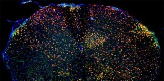 Study: Newly discovered immune cells play role in inflammatory brain diseases — (Details)