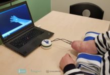 Research: The first dexterous and sentient hand prosthesis has been successfully implanted —