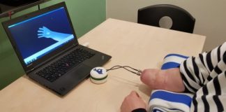 Research: The first dexterous and sentient hand prosthesis has been successfully implanted —