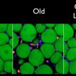 Study: HIV drug could treat Alzheimer’s, age-associated disorders — (Details)