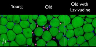 Study: HIV drug could treat Alzheimer’s, age-associated disorders — (Details)