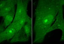 Research: The need to produce just the right amount of protein is behind the striking uniformity of sizes —