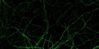 Research: Simple drug combination creates new neurons from neighboring cells —