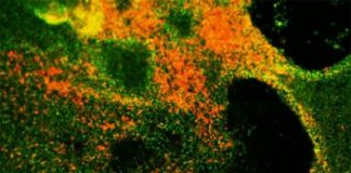 Study: Researchers develop human cell-based model to study small cell lung cancer — (Details)