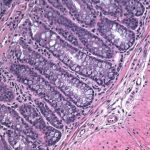 Study: To unravel programmed cell death pathways, investigators examine a molecule deemed unimportant, and find new function — (Details)