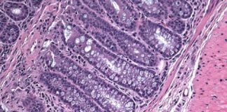 Study: To unravel programmed cell death pathways, investigators examine a molecule deemed unimportant, and find new function — (Details)