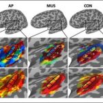 Study: Absolute pitch may be more strongly under genetic control than previously thought — (Details)