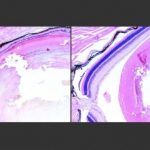 Study: Overactive repair system promotes cell death following DNA damage by certain toxins, study shows — (Details)