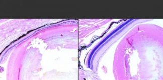 Study: Overactive repair system promotes cell death following DNA damage by certain toxins, study shows — (Details)