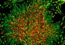 Research: Scientists compare the development of brain cells between humans and nonhuman primates in a novel way —