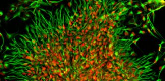 Research: Scientists compare the development of brain cells between humans and nonhuman primates in a novel way —