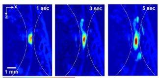 Study: Non-invasive imaging technique could greatly enhance cancer therapies — (Details)
