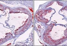 Research: Sleep-modulating hormone hypocretin found to also control production of inflammatory cells —