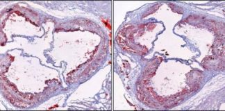 Research: Sleep-modulating hormone hypocretin found to also control production of inflammatory cells —