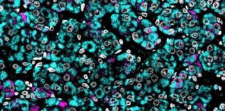 Study: ‘Backdoor’ pathway to masculinity involves androsterone from multiple tissues, including the placenta — (Details)