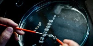 Study: Can we repair the brain? The promise of stem cell technologies for treating Parkinson’s disease — (Details)