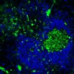 Study: On the origin of B1 cells — (Details)