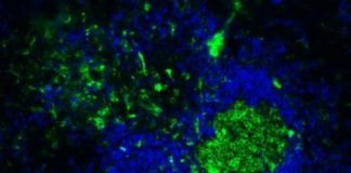 Study: On the origin of B1 cells — (Details)