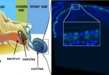 Research: Gene therapy durably reverses congenital deafness in mice —