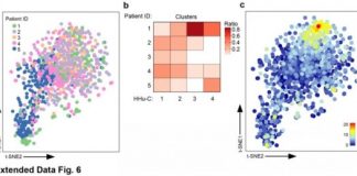 Study: Scientists create new map of brain’s immune system — (Details)