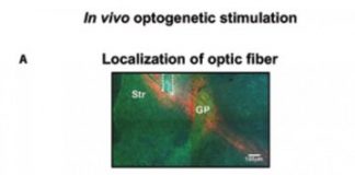 Study: Altered brain activity patterns of Parkinson’s captured in mice — (Details)