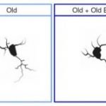 Study: Transplanting marrow from young lab mice to old mice preserves memory and learning skills — (Details)