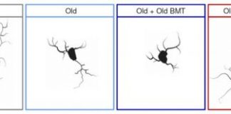 Study: Transplanting marrow from young lab mice to old mice preserves memory and learning skills — (Details)