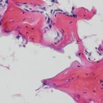 Study: Researchers define cells used in bone repair — (Details)