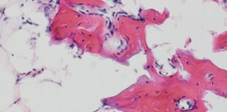 Study: Researchers define cells used in bone repair — (Details)