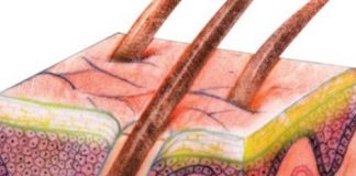 Study: Children with both conditions have abnormal skin near eczema lesions, research finds — (Details)