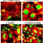 Study: New compound offers superior therapeutic approach to treat MS — (Details)