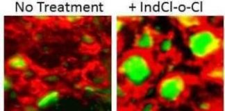 Study: New compound offers superior therapeutic approach to treat MS — (Details)