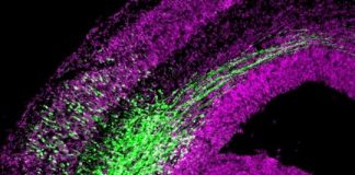 Study: New mechanisms regulating neural stem cells — (Details)
