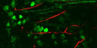 Study: How the brain processes images — (Details)