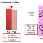 Study: How diabetes causes muscle loss — (Details)