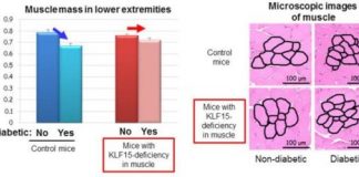 Study: How diabetes causes muscle loss — (Details)