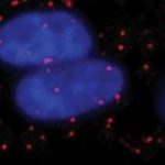 Study: Researchers are first to count growth factors in single cells — (Details)