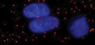 Study: Researchers are first to count growth factors in single cells — (Details)