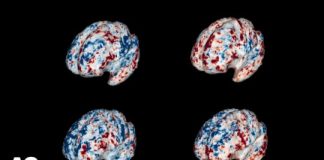 Study: Partnered with machine learning, brain scans reveal how people understand objects in our world — (Details)