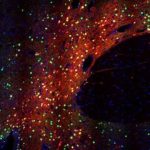 Study: Robust and specific gene regulation tool developed for primary brain neurons — (Details)