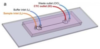 Study: New microfluidics device can detect cancer cells in blood — (Details)