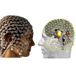 Study: A gentle method for unlocking the mysteries of the deep brain — (Details)