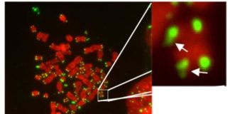Study: What controls the tips of our chromosomes? — (Details)